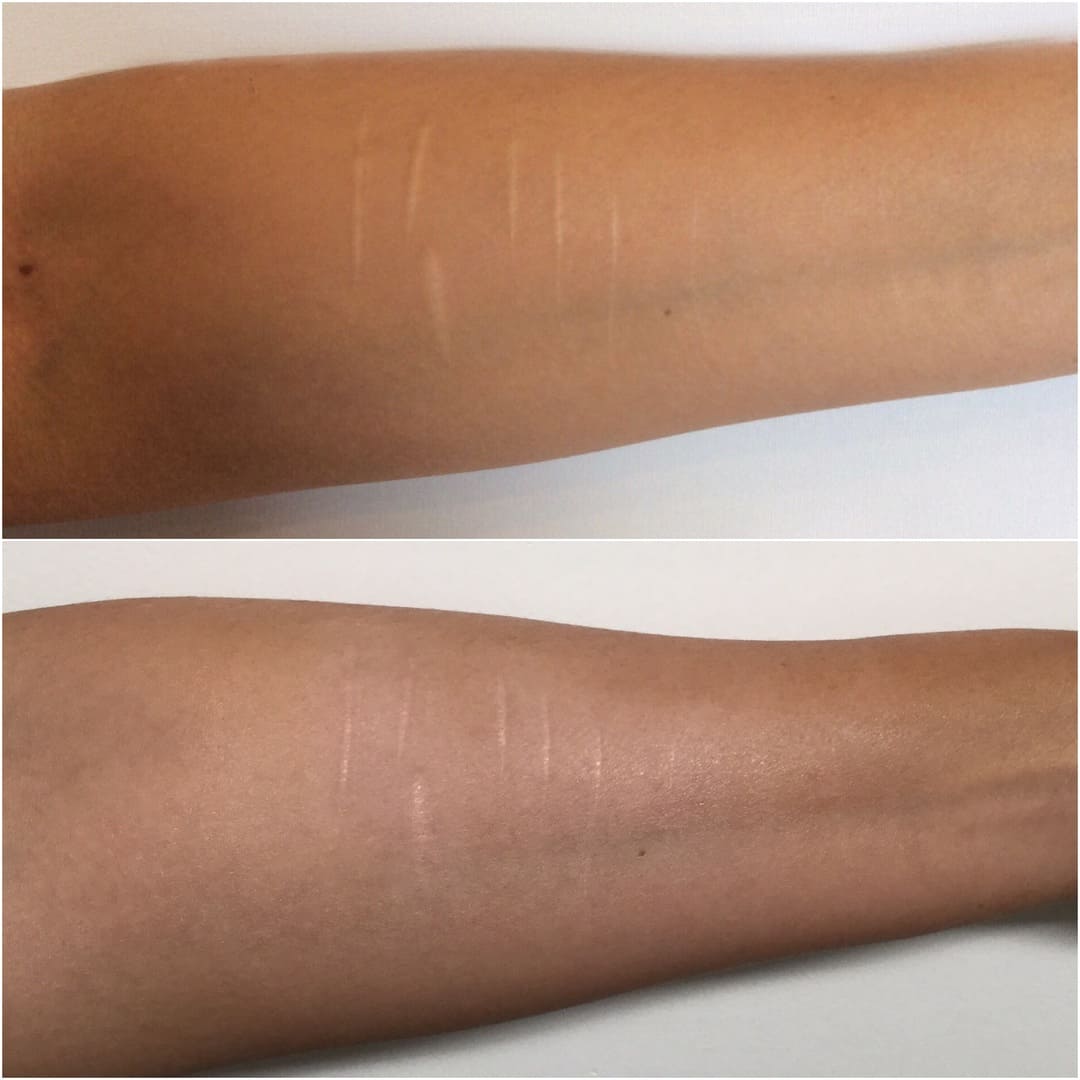 Before and After - Self-Harm Scar