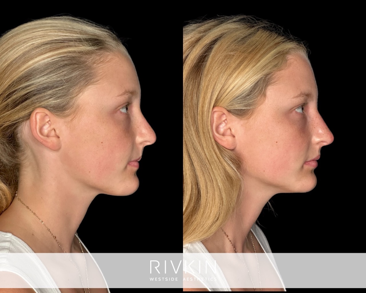 before and after photos