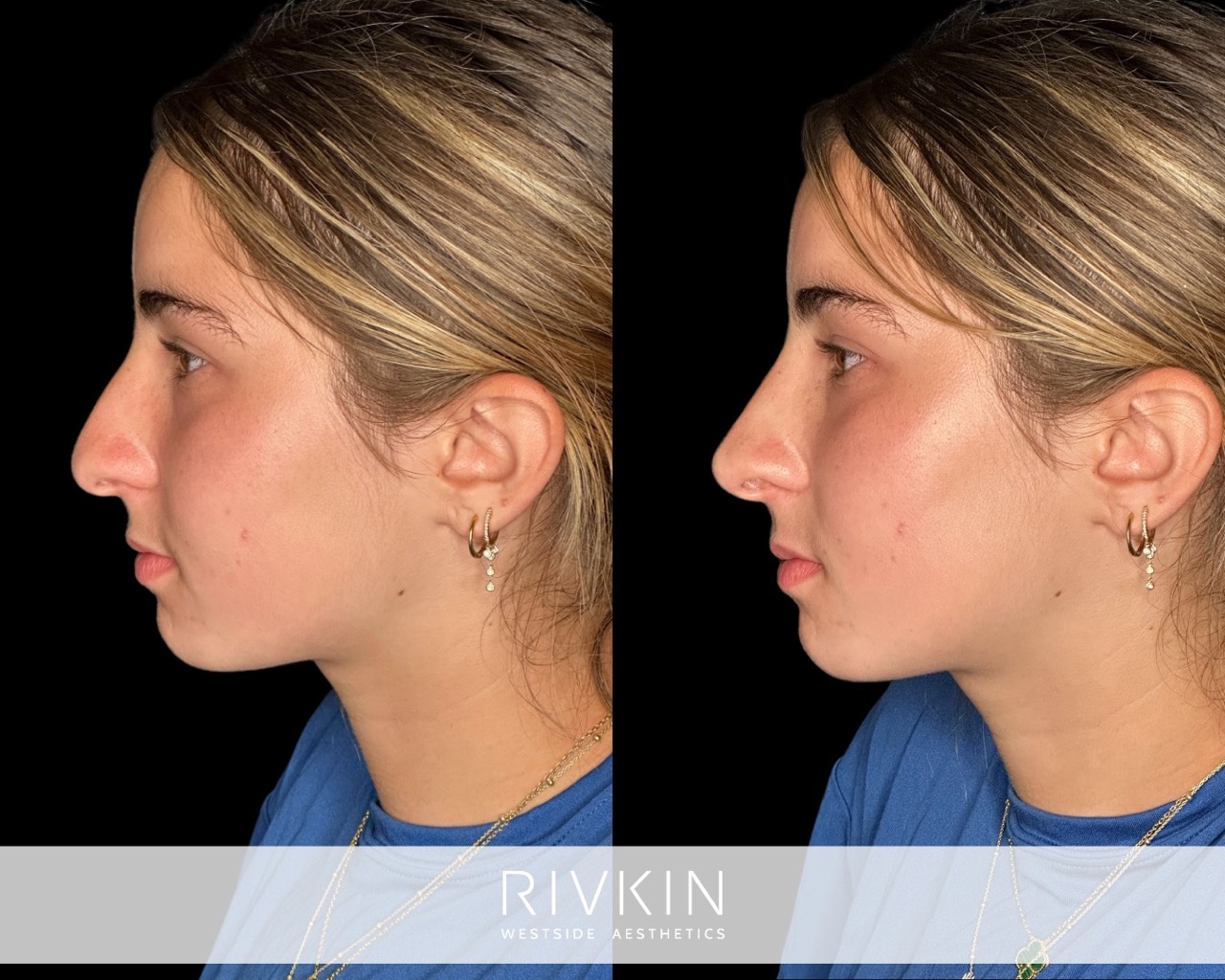 before and after photos
